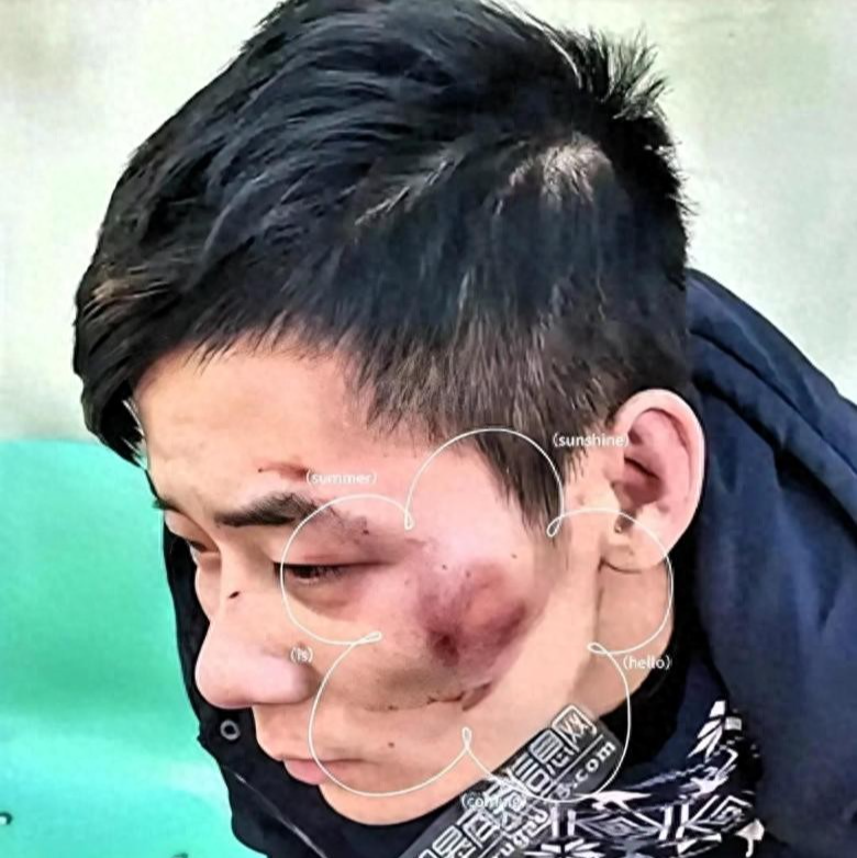 开云体育app下载-太猖狂！四川凌晨追打事件后续：6人一锅端，被查女子蛮横袭警